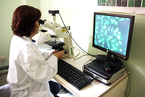 El Hospital de Manzanares agiliza el estudio de las enfermedades autoinmunes