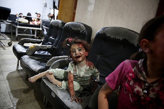 A young wounded Syrian girl waits for treatment at the Unified Medical Office for Douma, a make-shift medical centre in the rebel-held town of Douma, northeast of the capital Damascus, following reported heavy shelling and air strikes by government forces on the town killing nearly a dozen and injuring many children on June 16, 2015, according the Syrian Observatory of Human Rights. AFP PHOTO / ABD DOUMANYABD DOUMANY/AFP/Getty Images