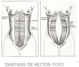 suelo-pelvico-03