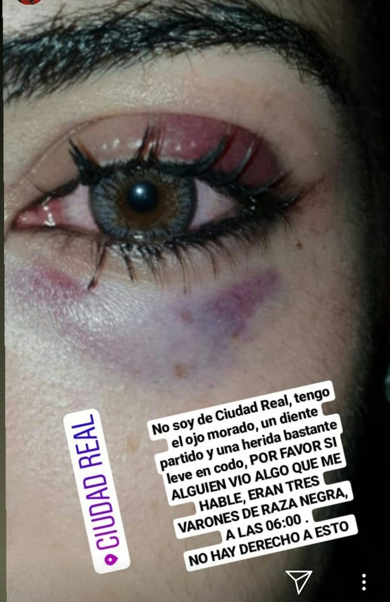 Ciudad Real: Una chica es trasladada al Hospital tras una agresión sexista en las inmediaciones del recinto ferial