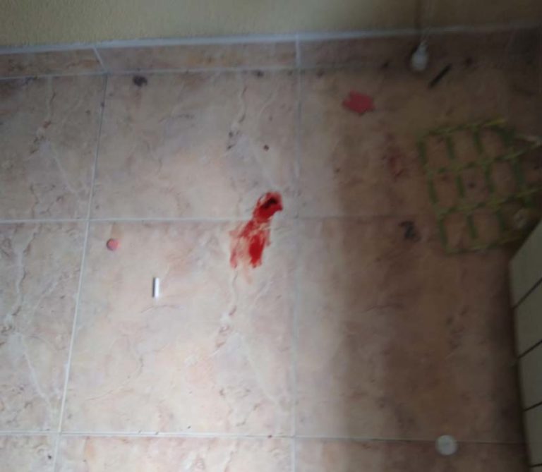 Ciudad Real: Vecinos de Puerta de Toledo denuncian la presencia de ratas que hasta se meten en los hogares