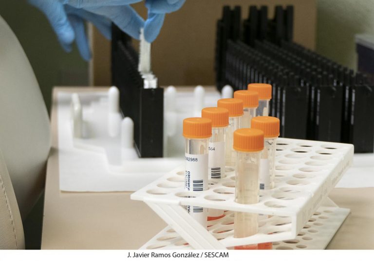 Castilla-La Mancha registra un nuevo caso de viruela del mono, un varón de 36 años