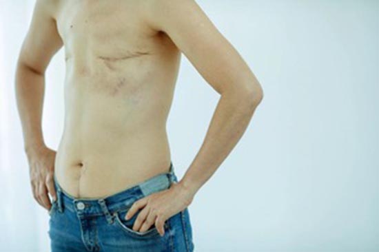 Los hombres también tienen cáncer de mama