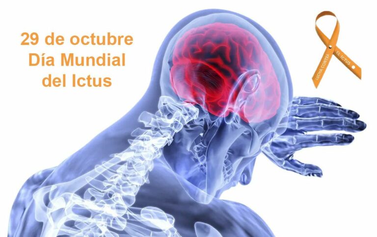 La importancia de la Fisioterapia en la rehabilitación tras sufrir un ictus