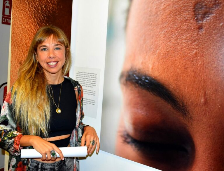 Puertollano: Sonia Carrero expone su muestra fotográfica «Cicatrices» en la Casa de Baños